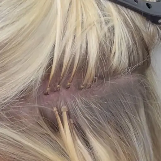 Tiny microbeads hidden in fine blonde hair